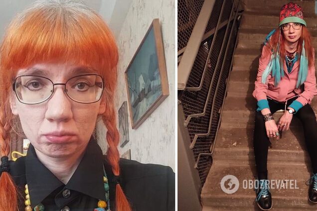 Вынуждена выживать: скандальная Бильченко пожаловалась, что Россия ее 'кинула'