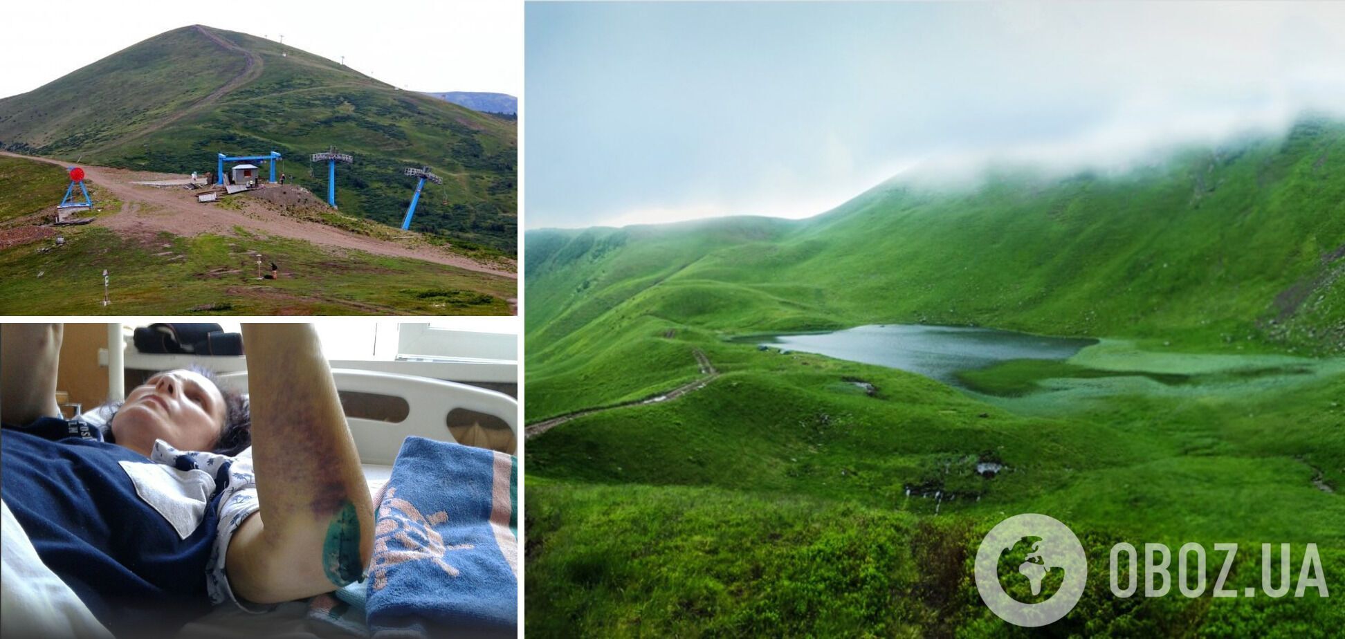 'За мить стала інвалідом': відпочинок у Карпатах закінчився для родини з Маріуполя трагедією