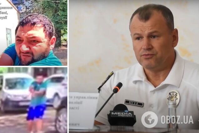 Установлена личность киллера, убившего человека в Одессе, и причина нападения. Видео