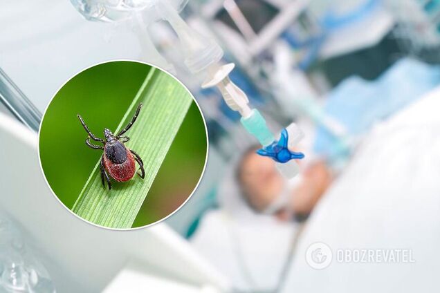 Укус клеща – последствия