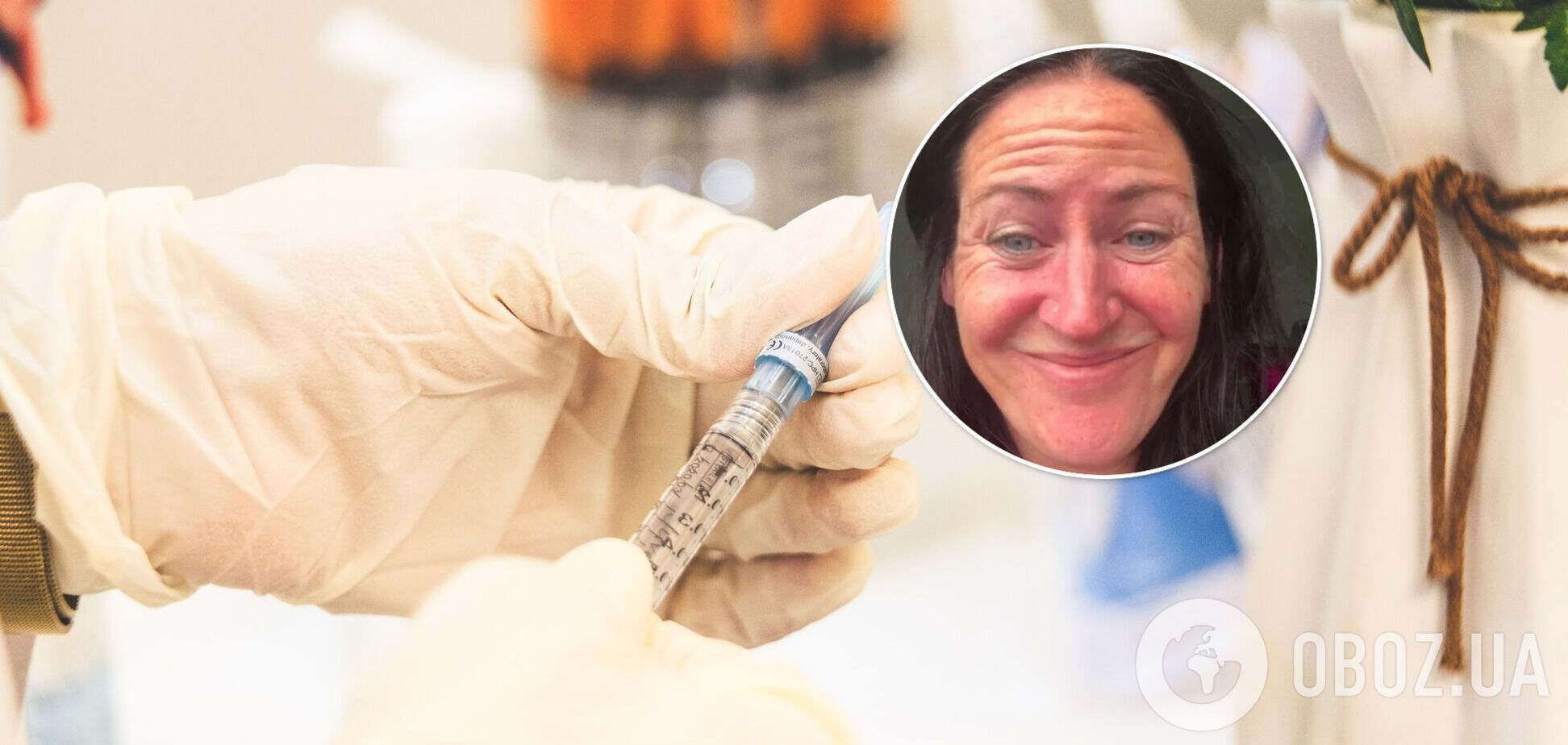 Лицо до и после ботокса