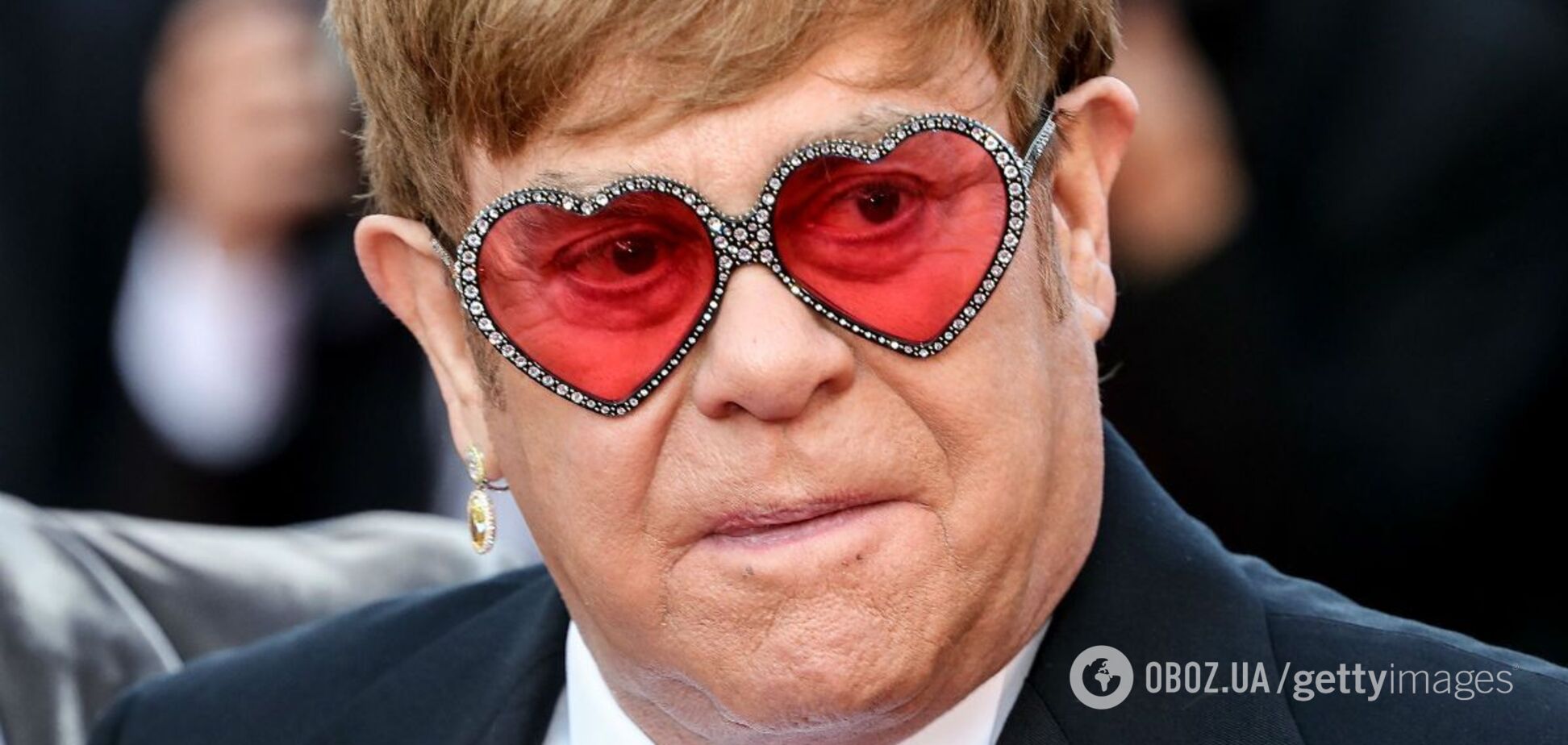 74-летний Элтон Джон получил серьезную травму: он почти не ходит