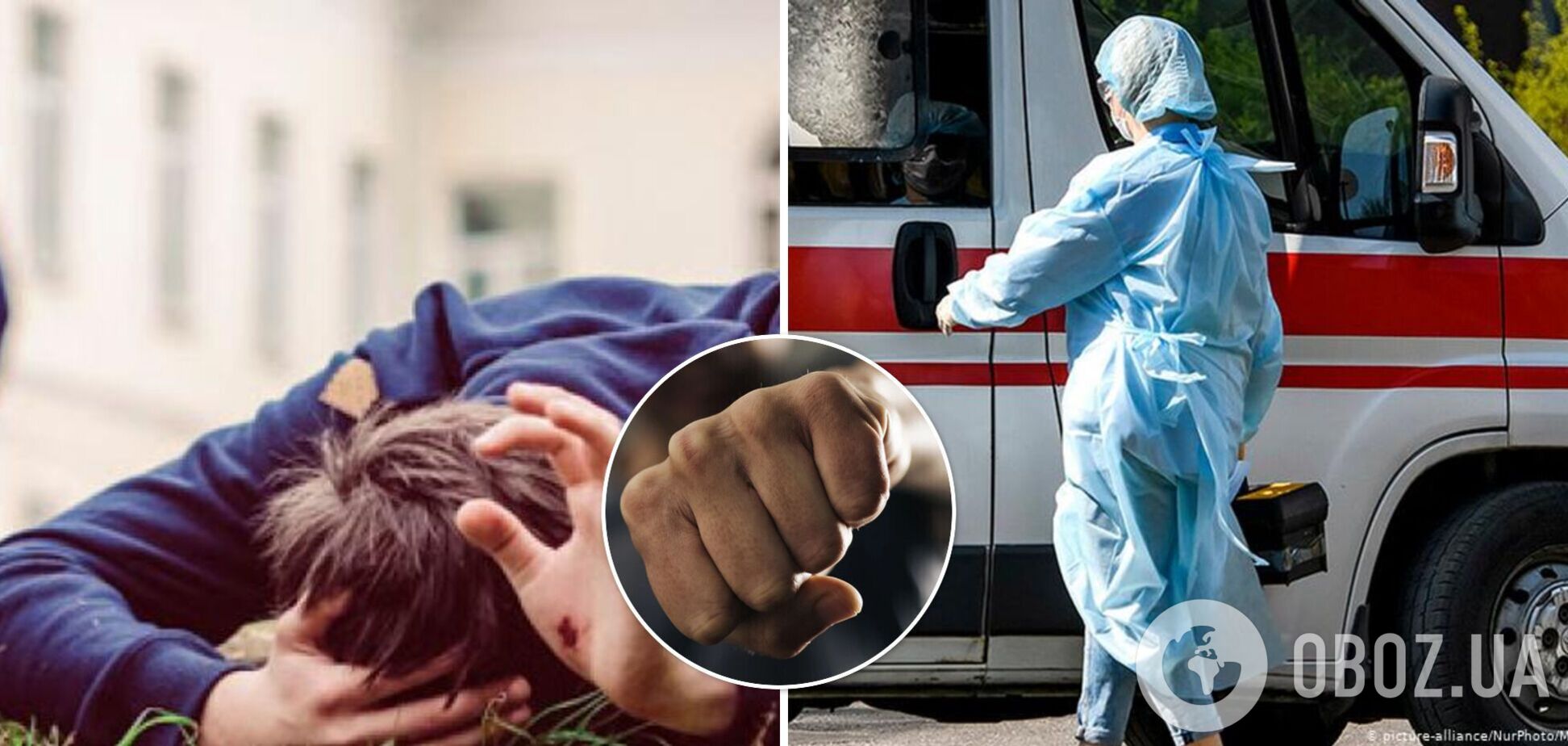 У Миколаєві школярі побили дитину на спортмайданчику: хлопчик потрапив до лікарні