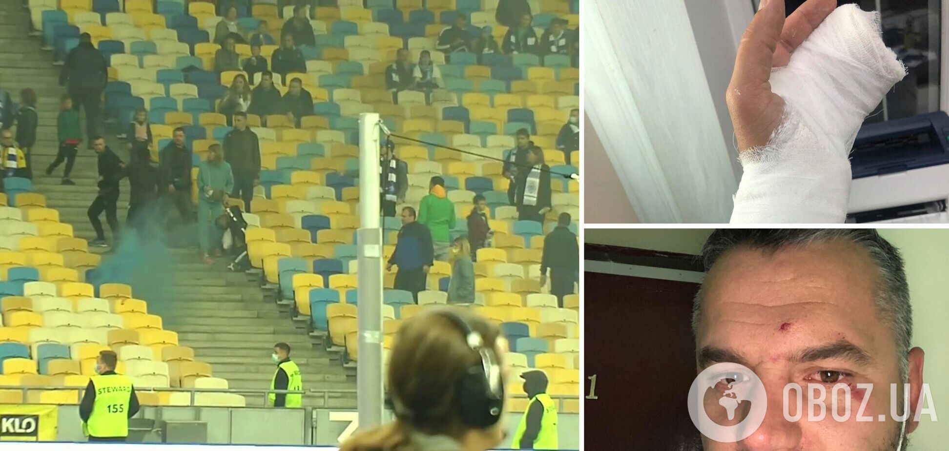 Напад ультрас 'Динамо