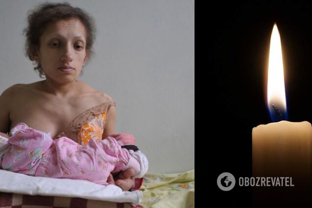 На Львівщині померла найнижча мама в Україні. Фото