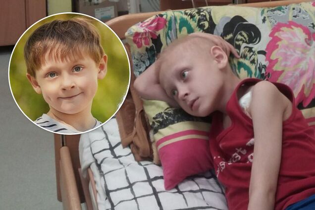 9-річному Єгору з Києва потрібна допомога