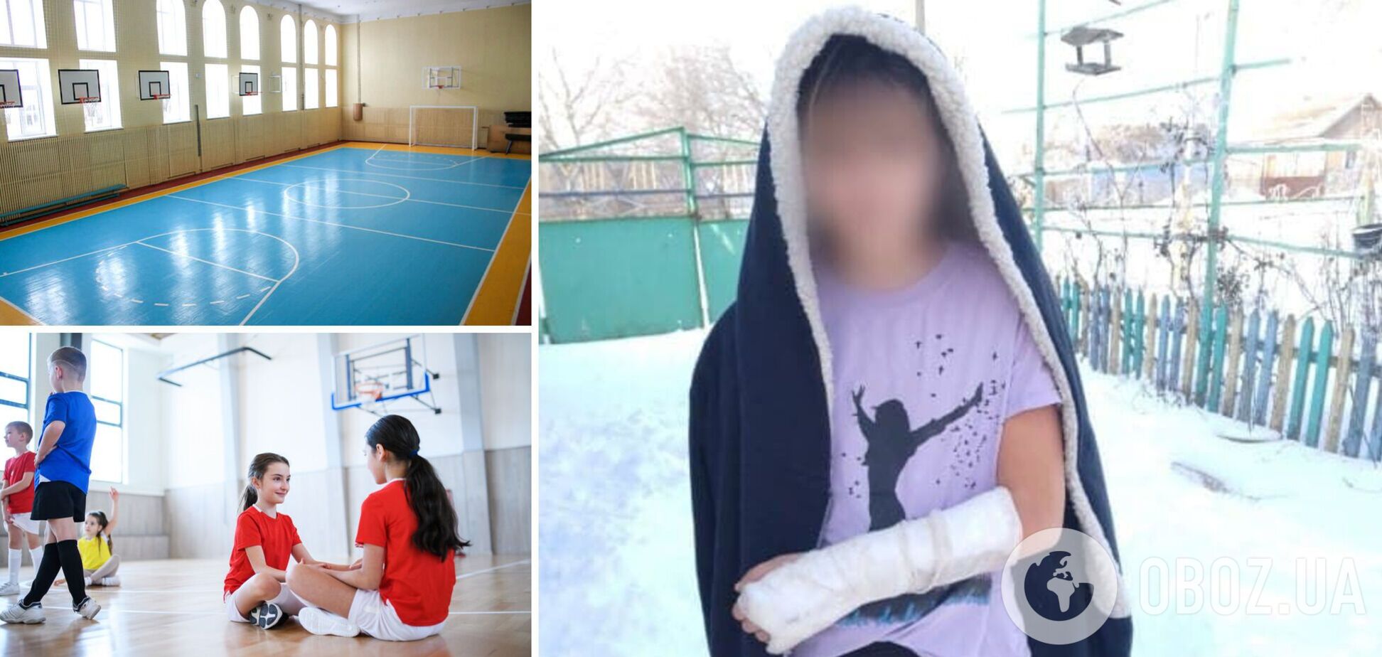 В Одесской области ученица 6 класса сломала руку, но педагоги даже не вызвали скорую помощь