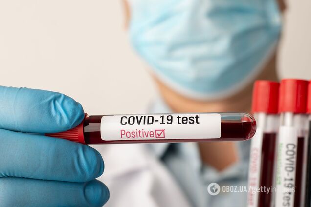 У Франції новий максимум щодо кількості випадків, а Польща переступила межу 100 тис. смертей. Хроніка коронавірусу на 11 січня