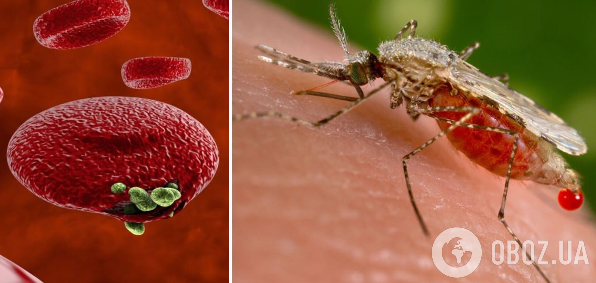 В Харькове студент из Конго госпитализирован с малярией