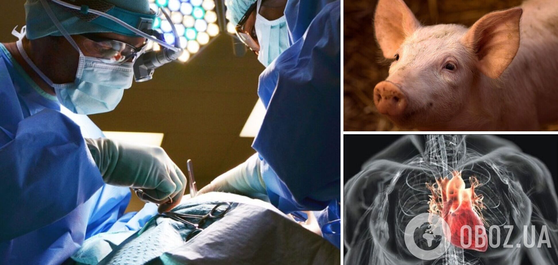 В США впервые успешно пересадили человеку сердце свиньи: врачи рассказали об уникальной операции