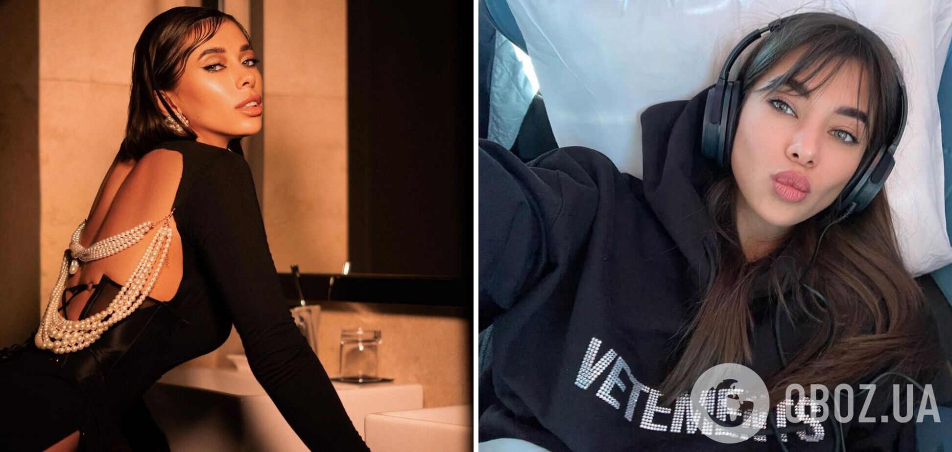 'Міс Україна Всесвіт' Анна Неплях показала, як виглядала до збільшення губ