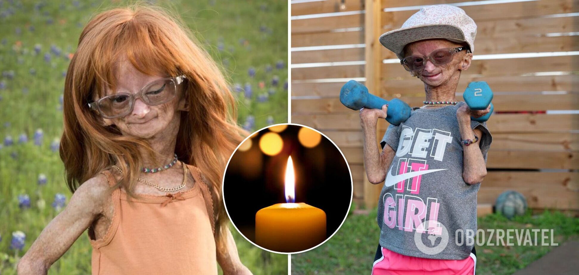 Умерла 15-летняя девочка и звезда YouTube с лицом старушки