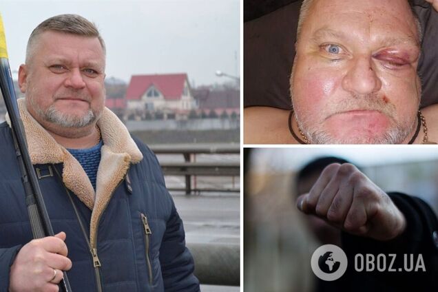 У Херсоні посеред вулиці побили депутата: зробив зауваження через петарди. Фото