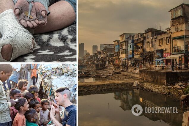 $1 на добу: як живуть люди в найбідніших країнах світу