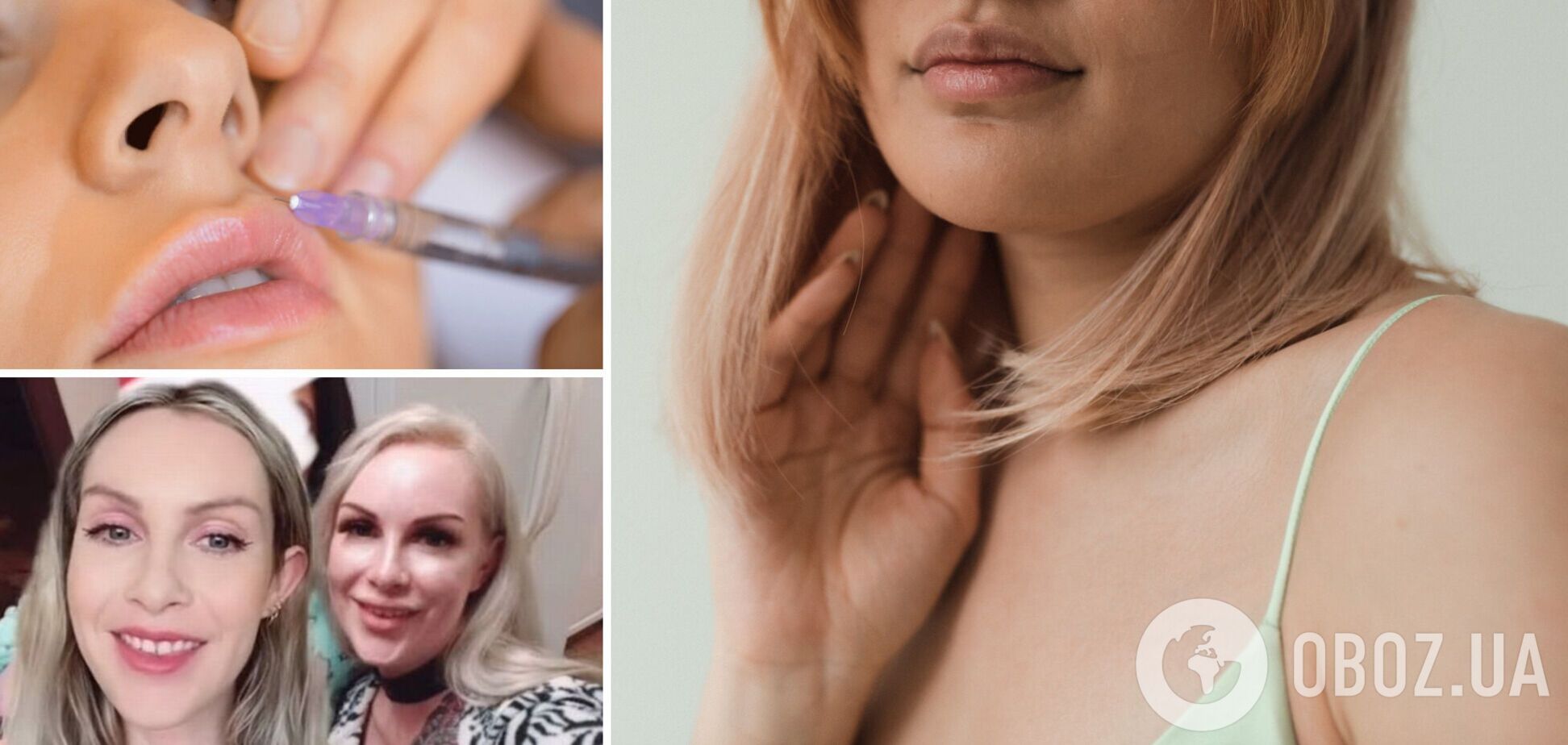 Косметолог зізналася, що переборщувала зі збільшенням губ