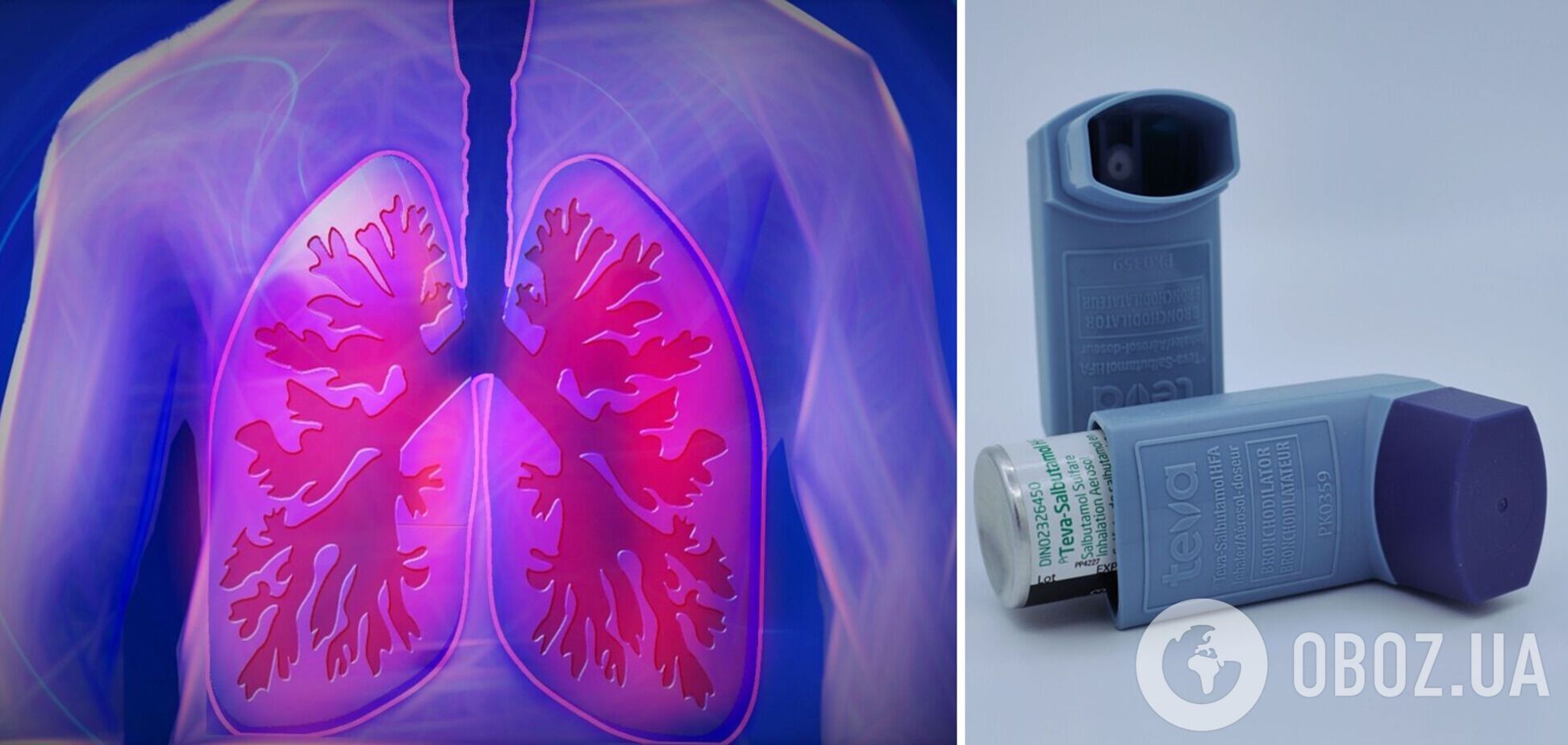Лікарі назвали сигнали хвороби легень, які не можна ігнорувати
