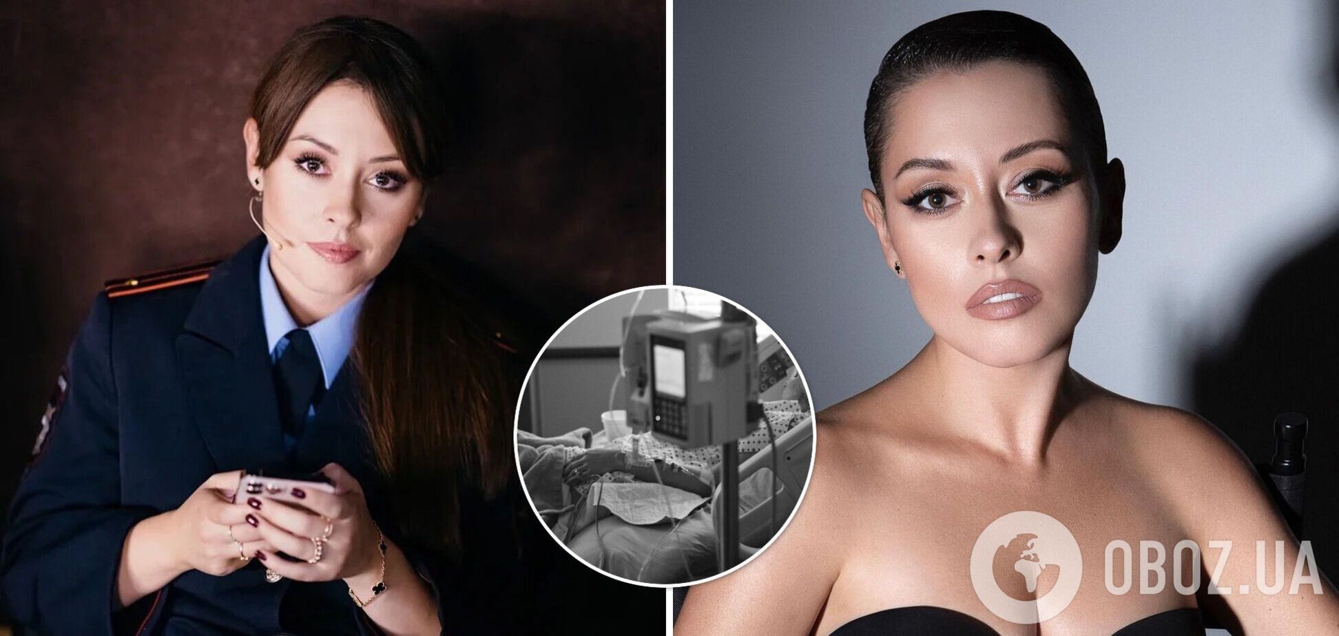 Російська акторка облисіла через коронавірус: втратила 70% волосся