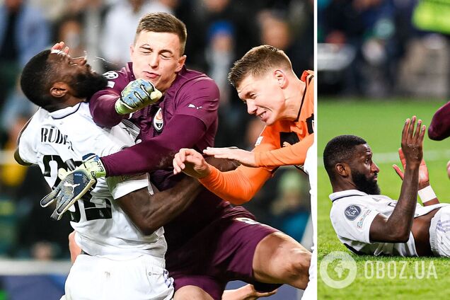 20 швов, не видно полголовы: футболист 'Реала' показал, как выглядит после жуткого столкновения с вратарем 'Шахтера'