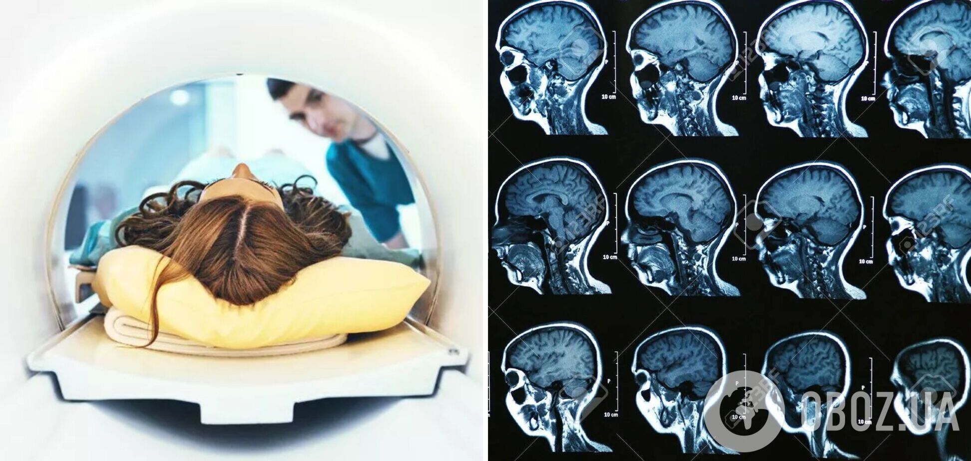 Ученые научились 'читать' человеческие мысли: как им это удалось