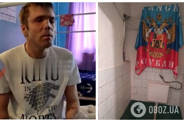 Остался без рук и ослеп: боевик, воевавший против Украины в 2014 году, пожаловался, что его 'кинули'. Видео