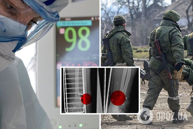 Врач из Беларуси рассказал, как лечил раненых солдат армии РФ в первые недели войны: их просто оставляли на каталках у входа