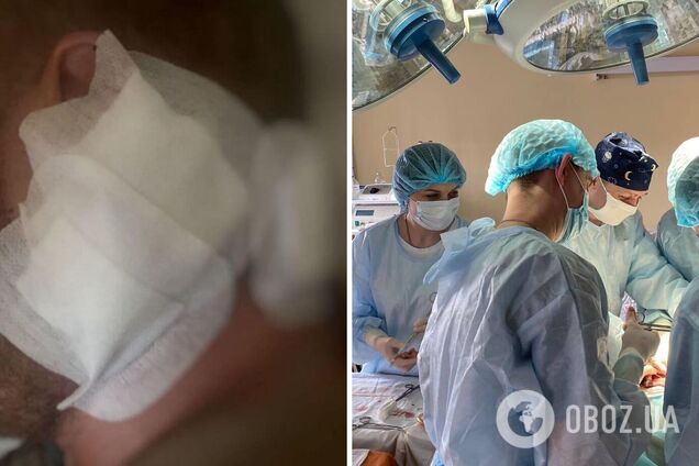 'Операція тривала декілька годин': у Дніпрі лікарям вдалося врятувати чоловіка, якому снайпер влучив в голову. Фото