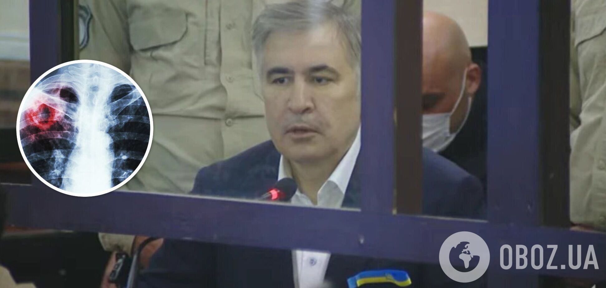 У Саакашвили в тюрьме диагностировали деменцию и туберкулез: что известно о его состоянии
