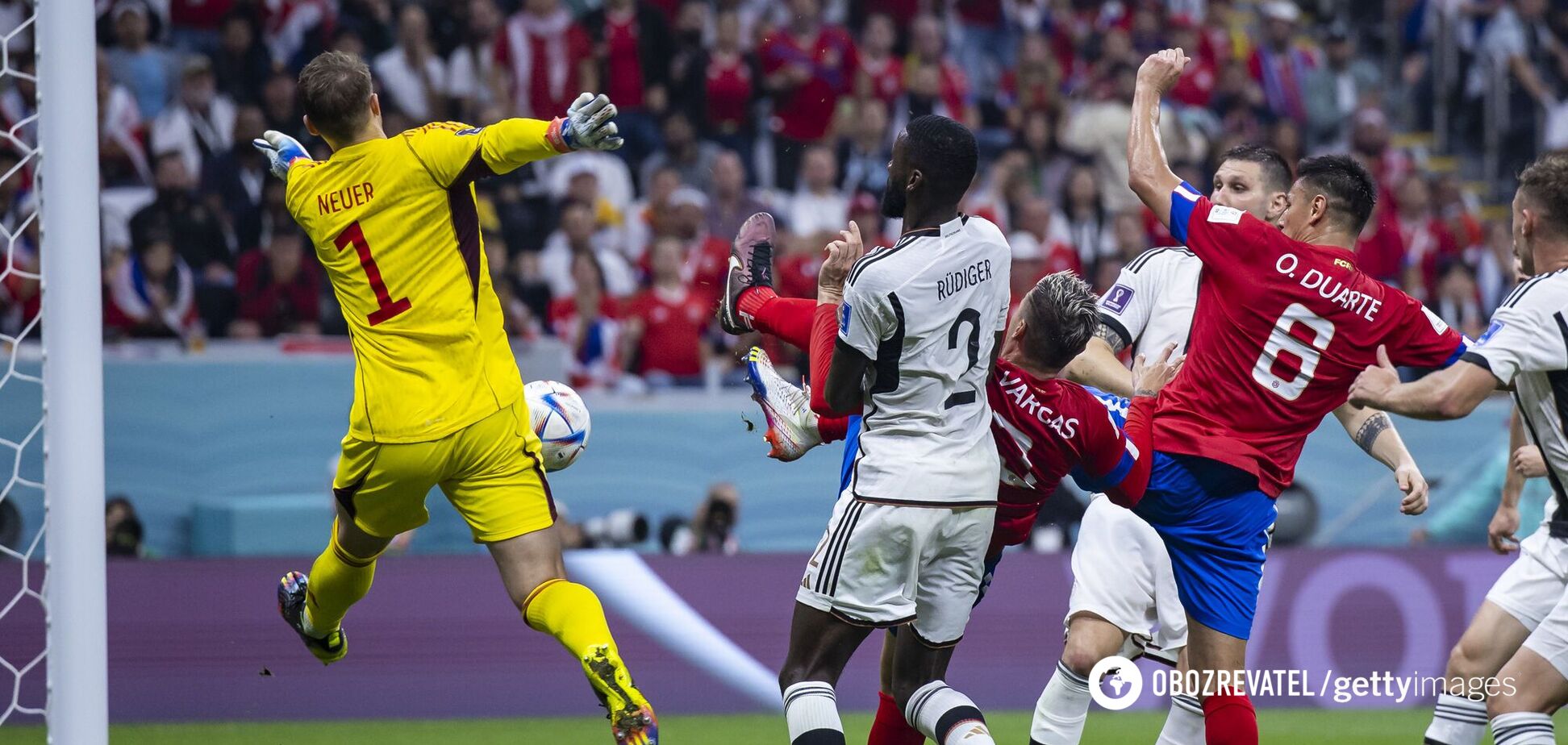 Нойер после вылета Германии с ЧМ-2022 снимал стресс на курорте и сломал ногу. Он пропустит полгода