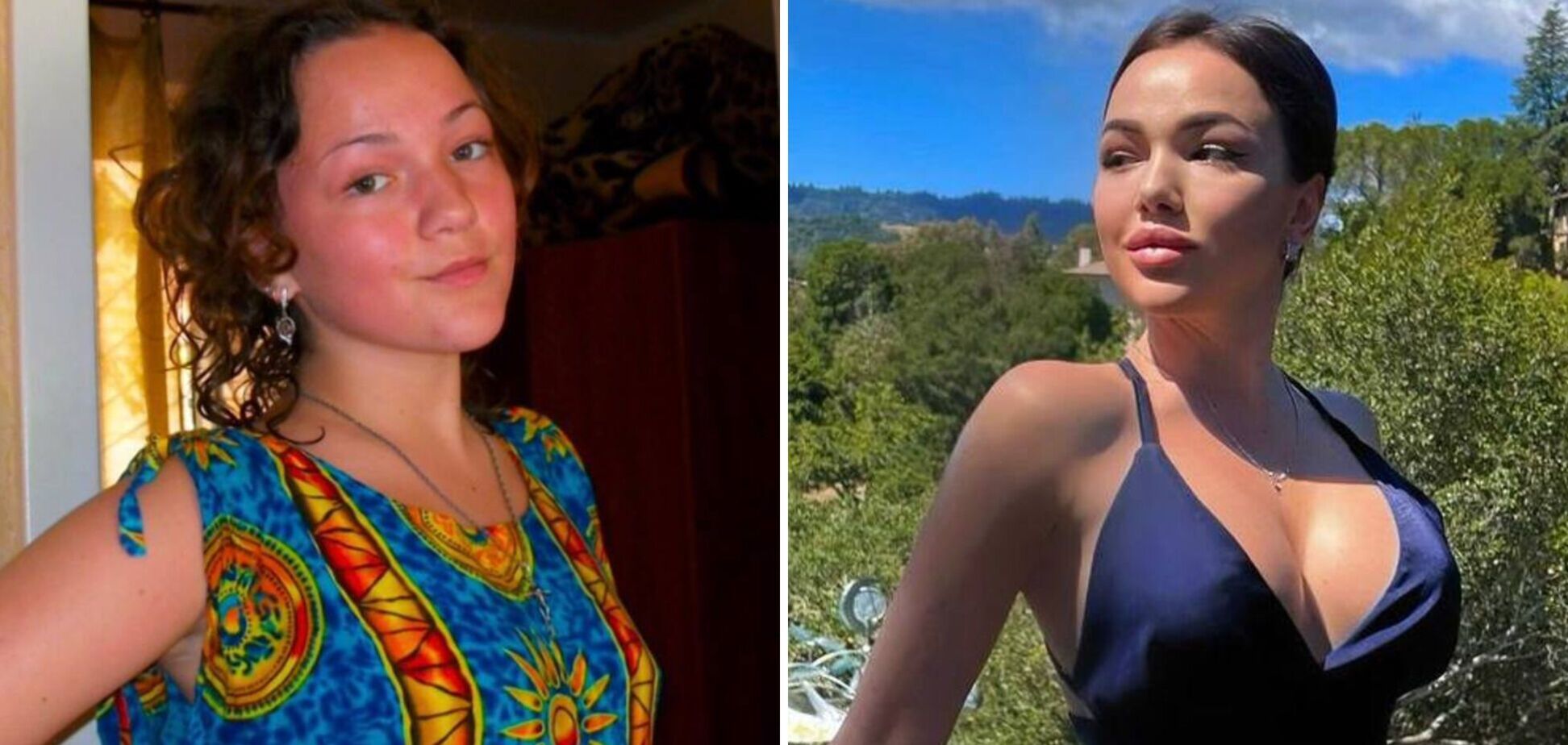 Із зайвою вагою та коротким волоссям: учасниця 'Холостяка' показала, який вигляд мала до пластики. Відео