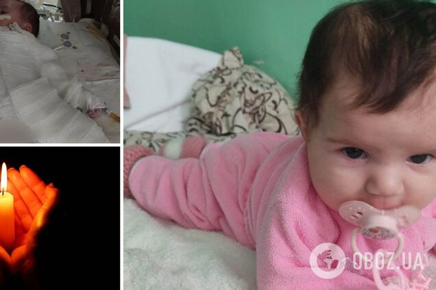 Маленькая девочка буквально сгорела на операции: подробности трагедии в городе Ривне