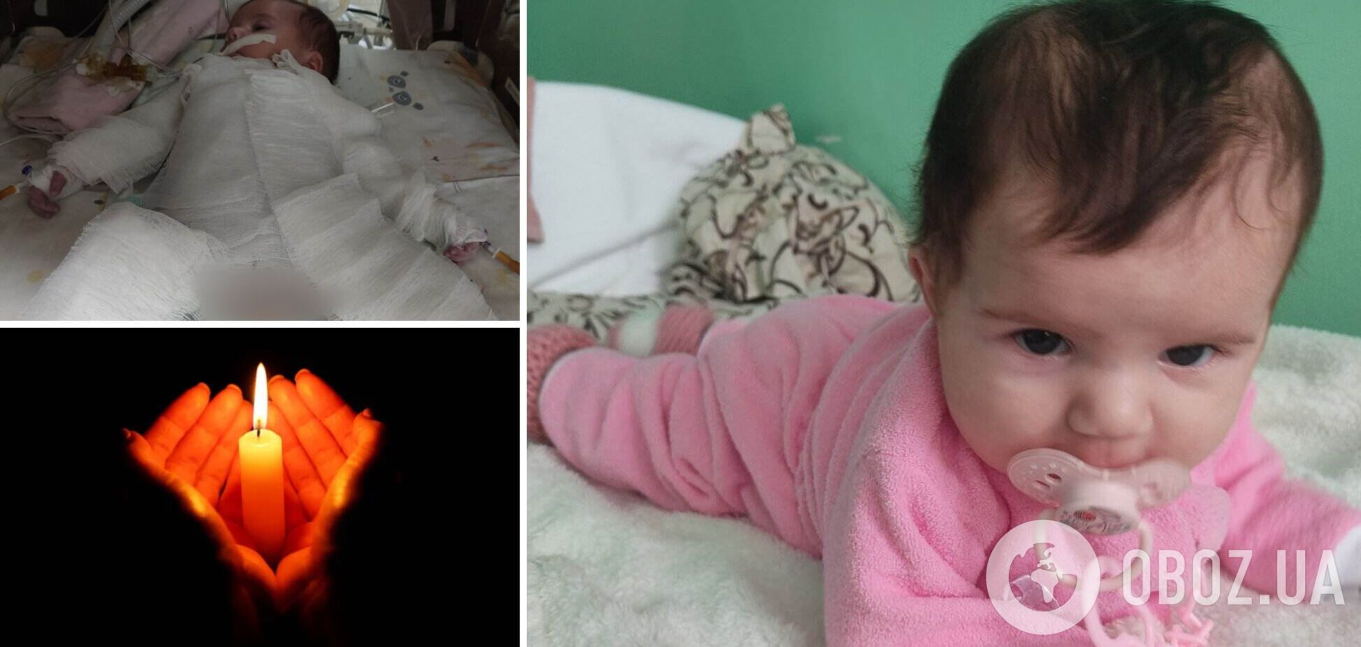 Маленька дівчинка буквально згоріла на операції: подробиці трагедії в Рівному