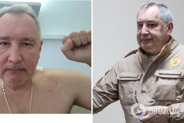 Рогозин показал первое фото после ранения в Донецке, но есть 'нюанс'