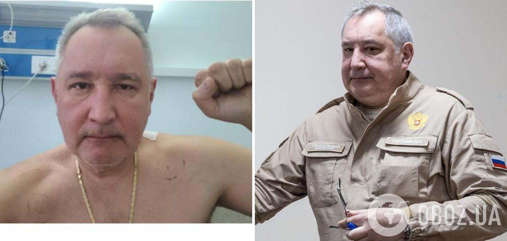 Рогозин показал первое фото после ранения в Донецке, но есть 'нюанс'