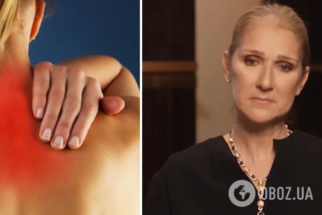 У Селин Дион обнаружили редкое неизлечимое заболевание