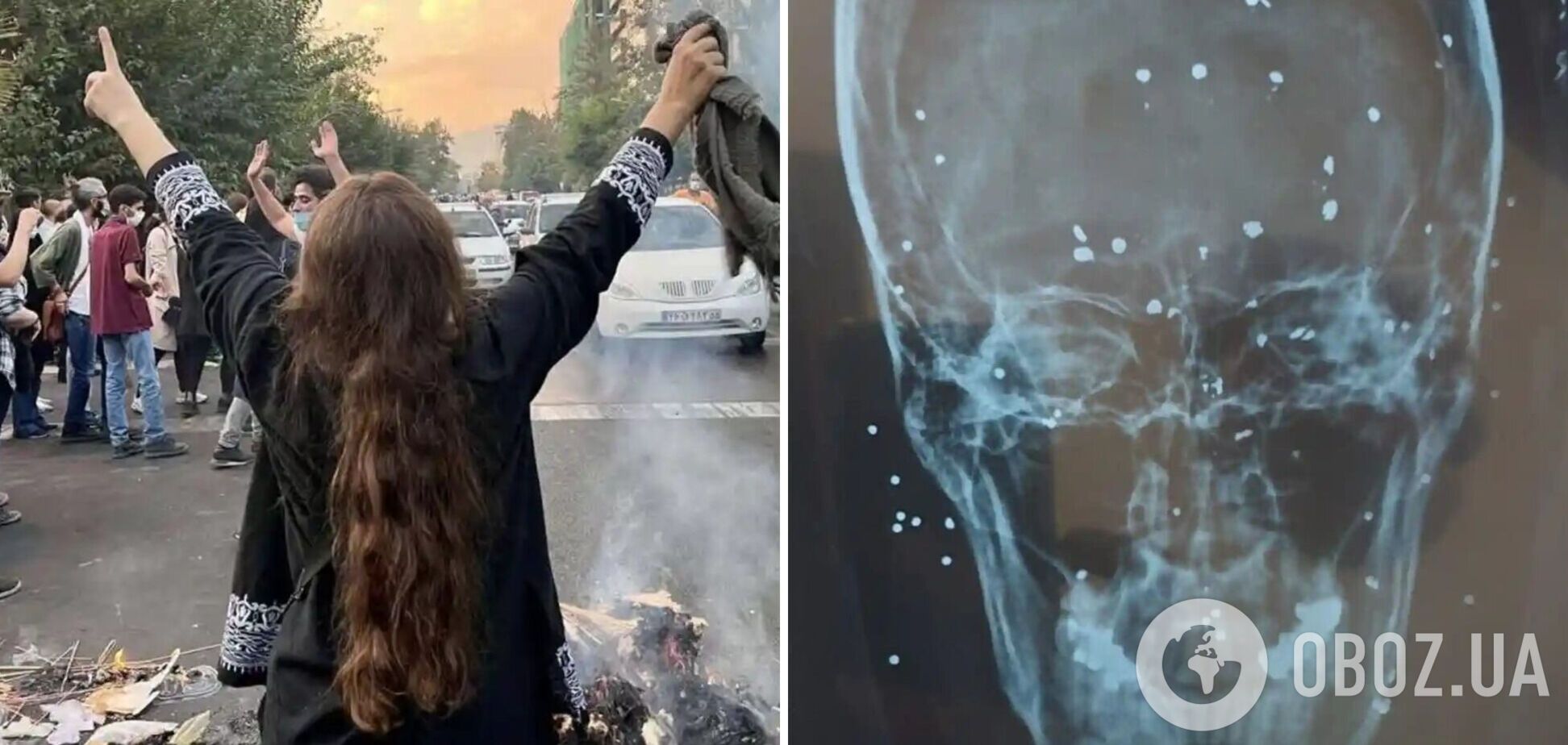 Жінкам цілять в обличчя та груди, чоловікам – у спини: The Guardian розповіла, як силовики в Ірані обирають 'мішені' на протестах