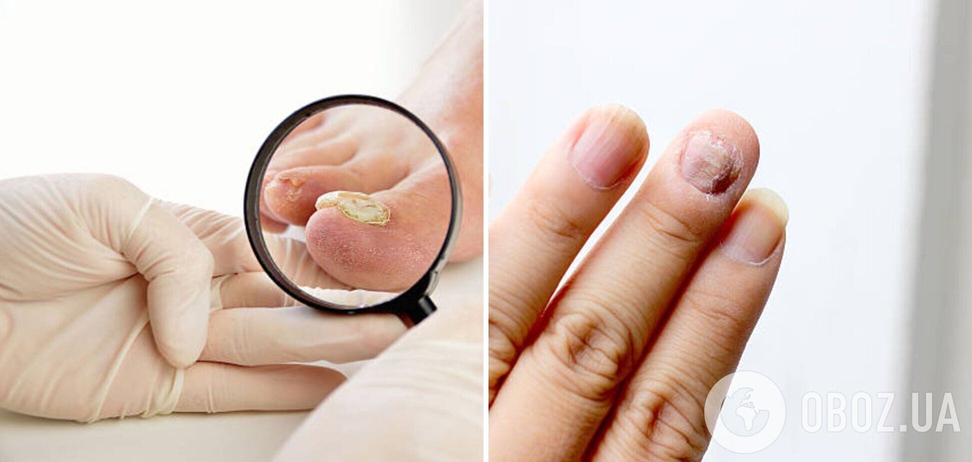 Специалисты рассказали, о чем может свидетельствовать вид ваших ногтей