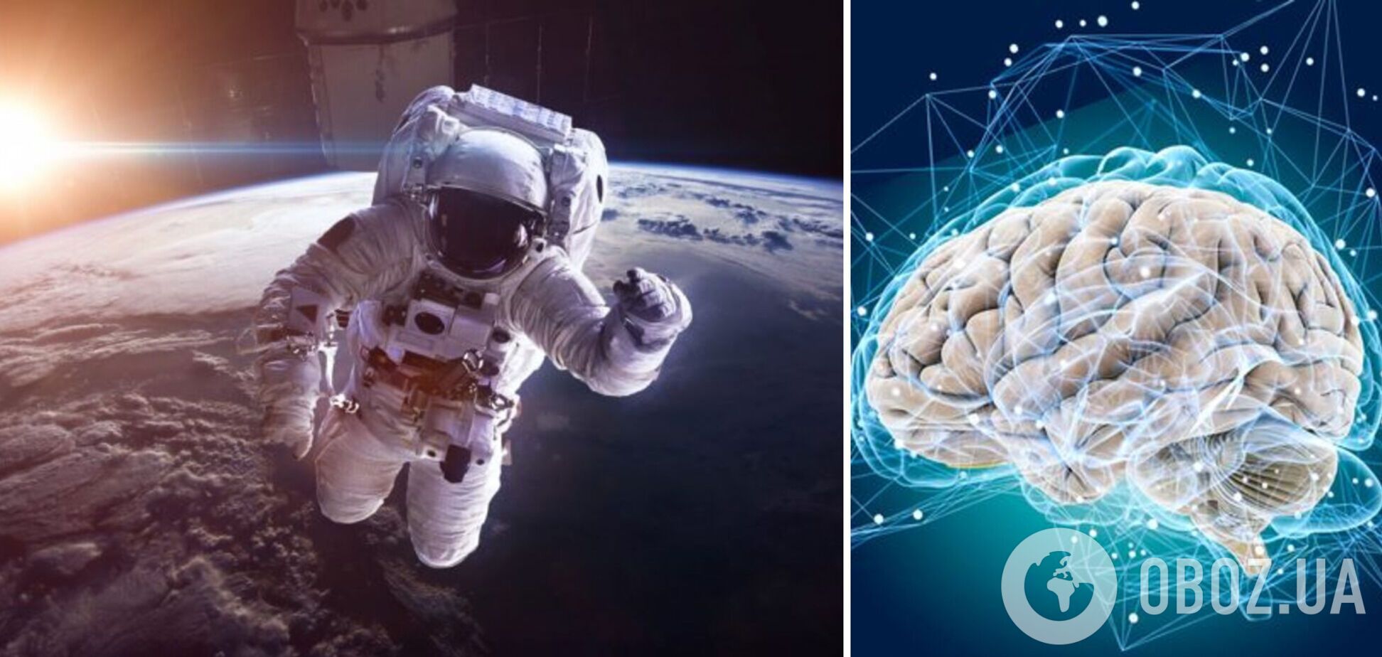 Что происходит с человеческим мозгом в космосе: ученые отследили изменения