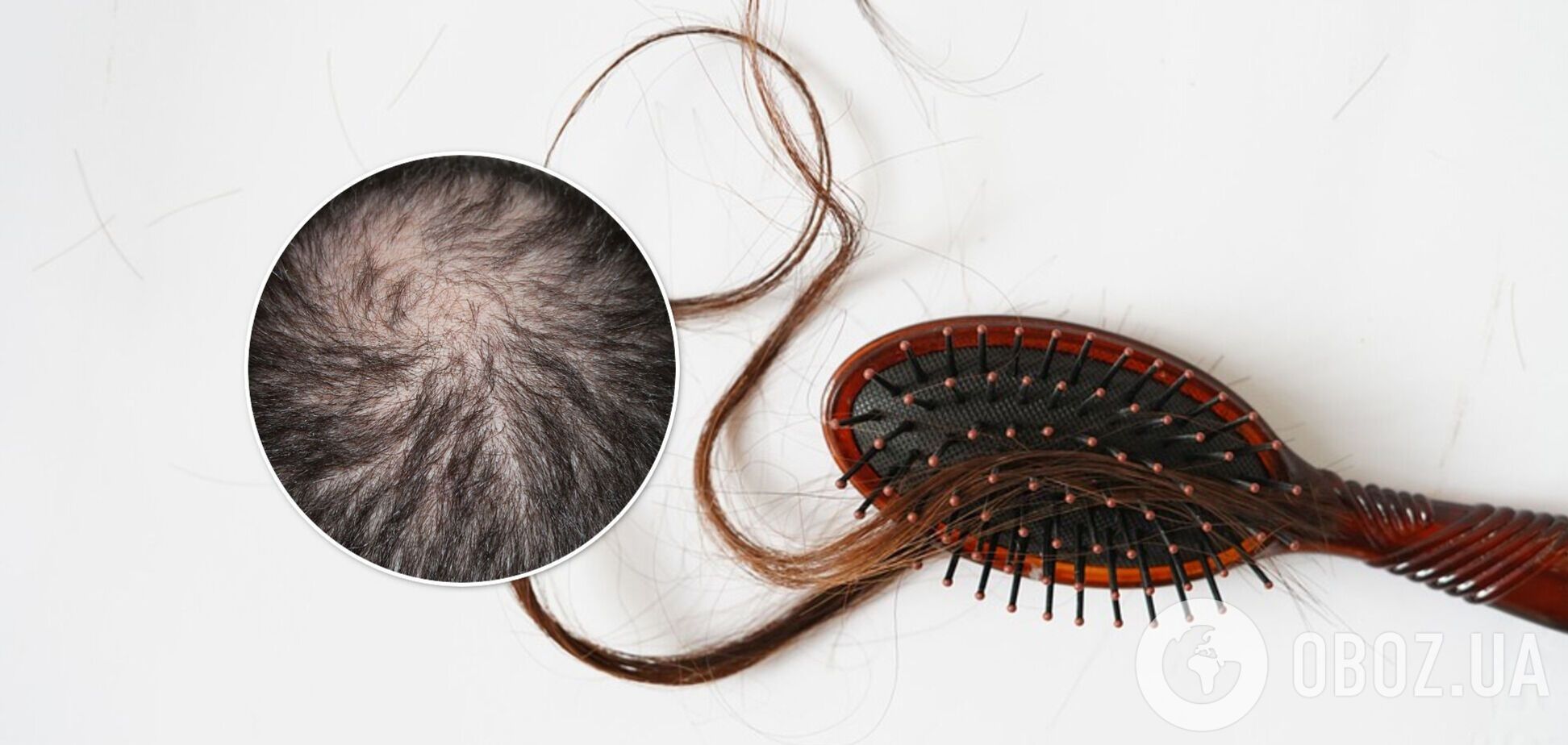 Не растирайте и не скручивайте полотенцем: врачи рассказали, как предотвратить выпадение волос