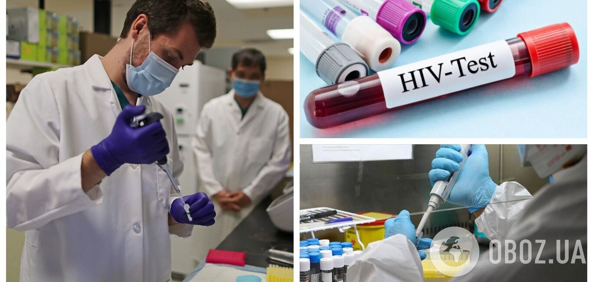 У Нідерландах виявили особливо заразний штам ВІЛ, який швидше послаблює імунну систему