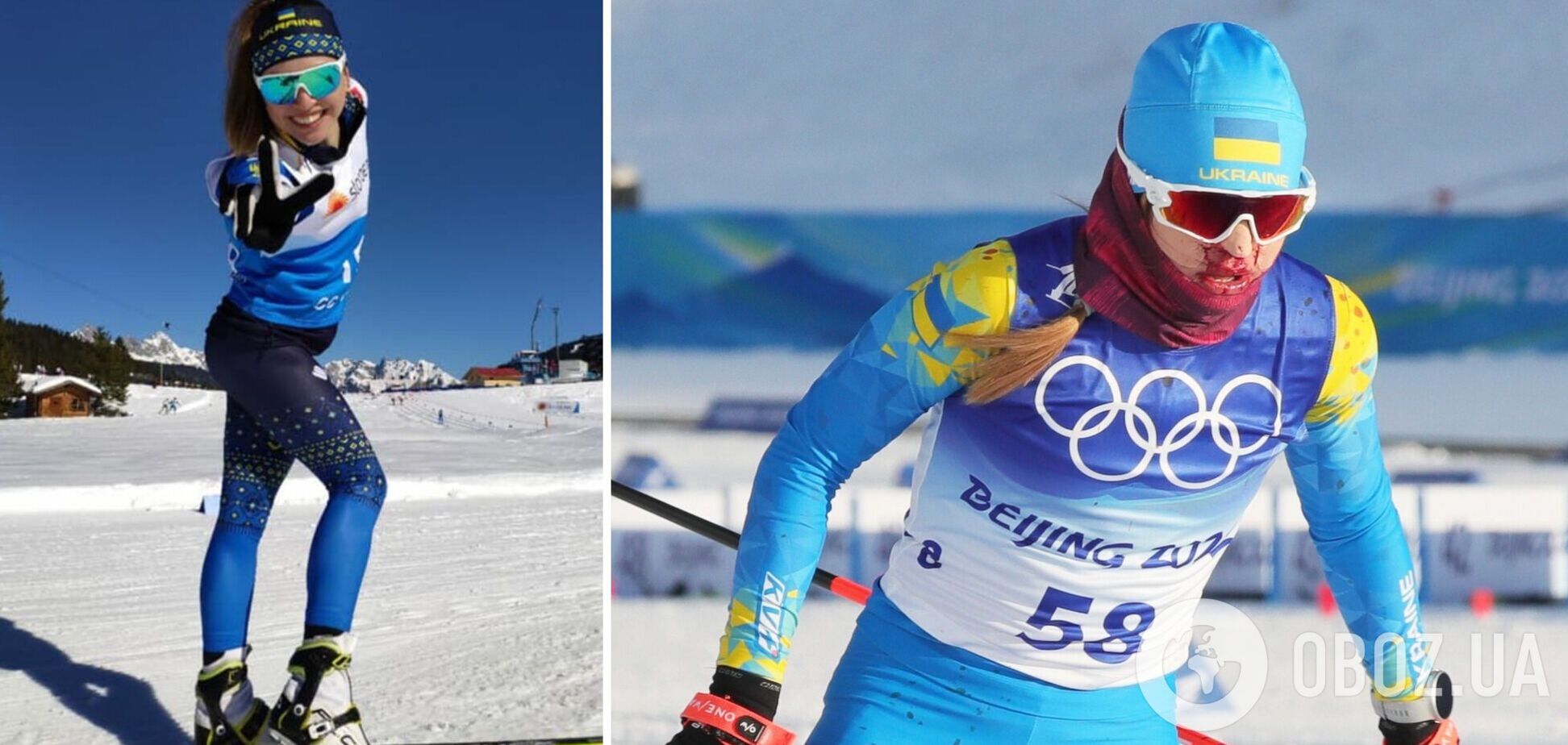 'Почало нудити': що сталося з українською лижницею у першій гонці Олімпіади-2022. Ексклюзив
