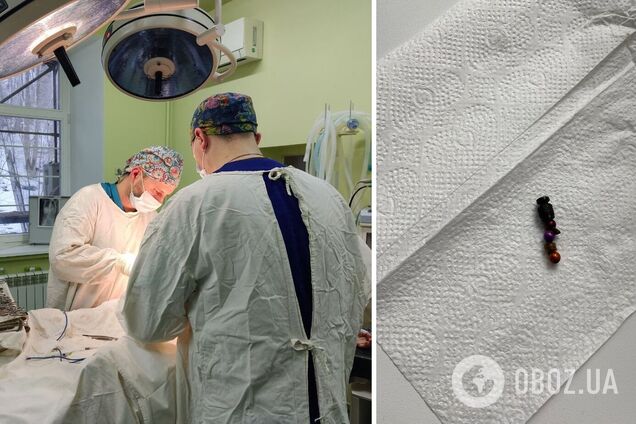 Во Львове из живота 2-летнего ребенка достали магниты