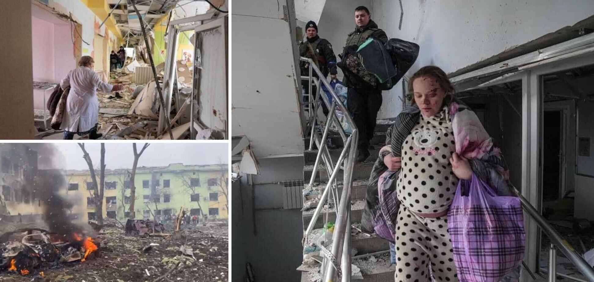 Жителька Маріуполя, яка потрапила під авіаудар російської армії у пологовому будинку, народила дівчинку