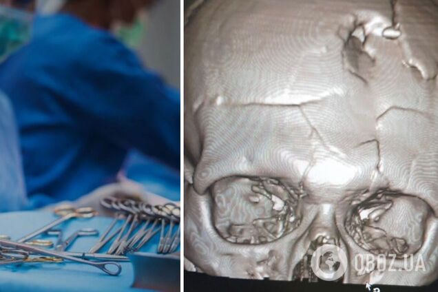 Медики больницы Мечникова в Днепре спасли раненого с прямым пулевым попаданием в голову. Фото