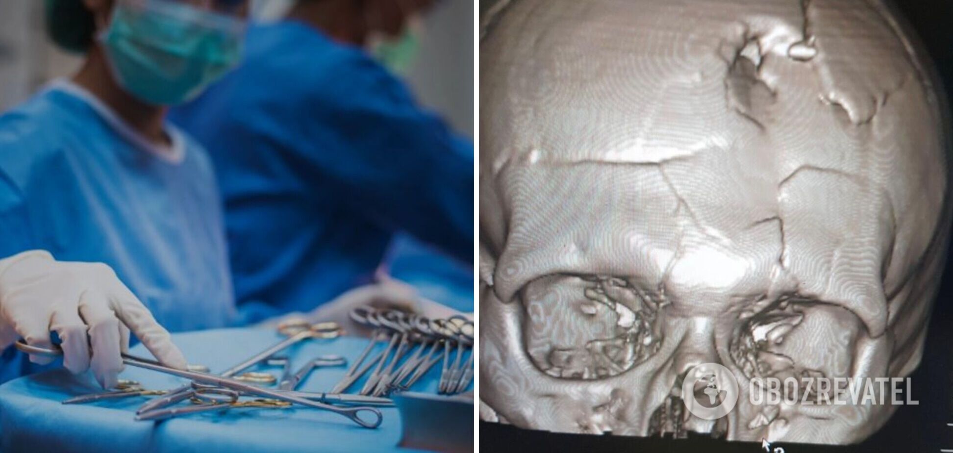 Медики лікарні Мечникова у Дніпрі врятували пораненого із прямим кульовим влучанням у голову. Фото