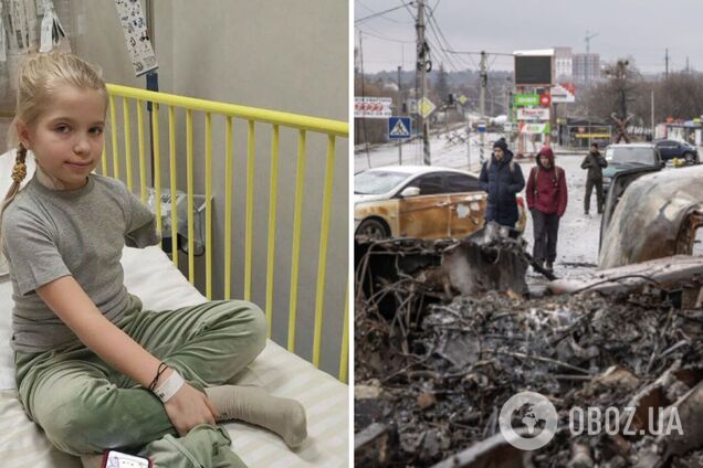 'Саша – героиня': попавшей под обстрел оккупантов при эвакуации из Гостомеля девочке пришлось ампутировать руку. Фото