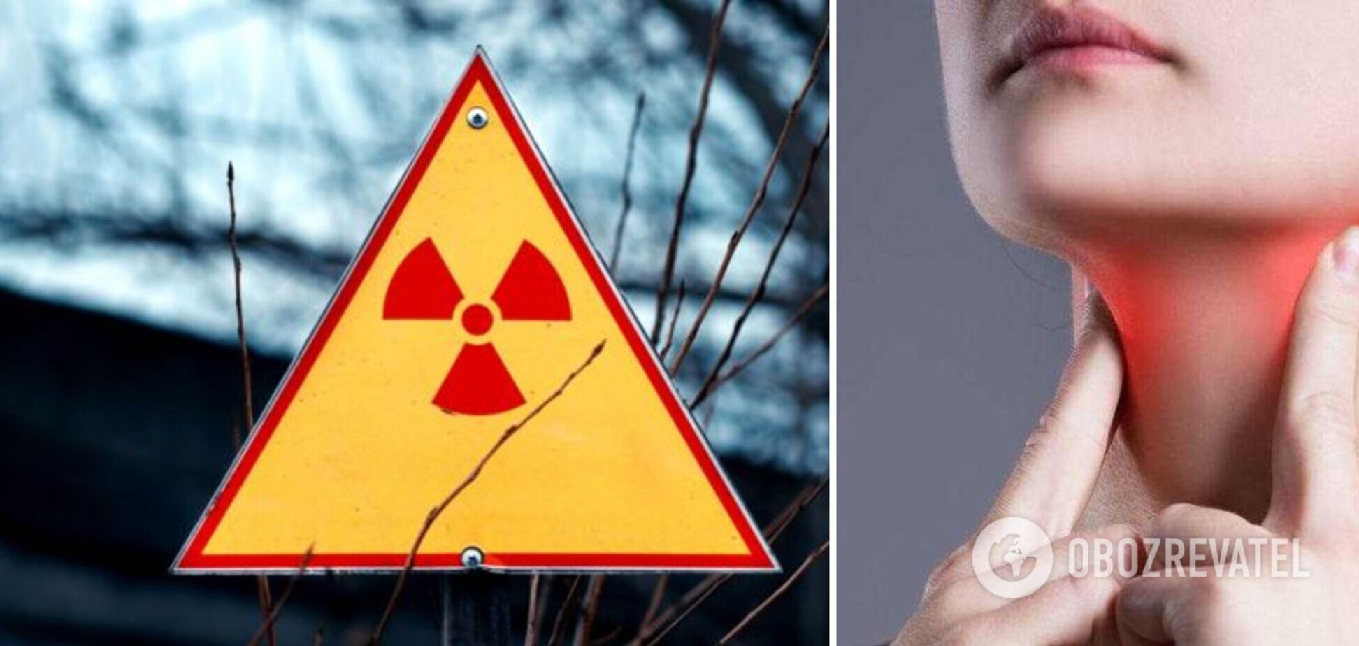 Что делать при радиационной аварии: в Минздраве дали четкую инструкцию. Фото