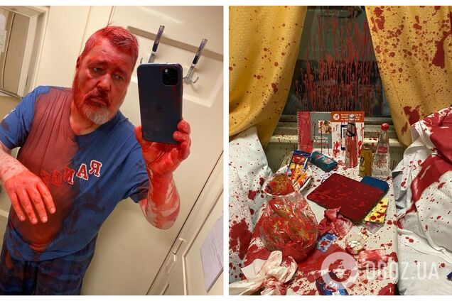 У Росії лауреата Нобелівської премії, який виступив проти війни з Україною, облили фарбою. Фото