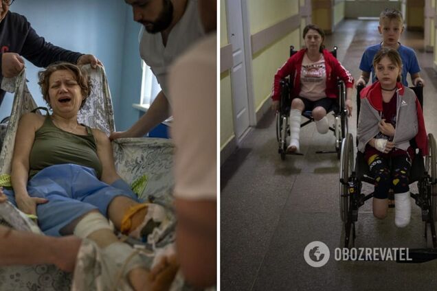 'Каждый день привыкаю к новой боли': украинцы получили тяжелейшие увечья в результате российских обстрелов. Фото 18+