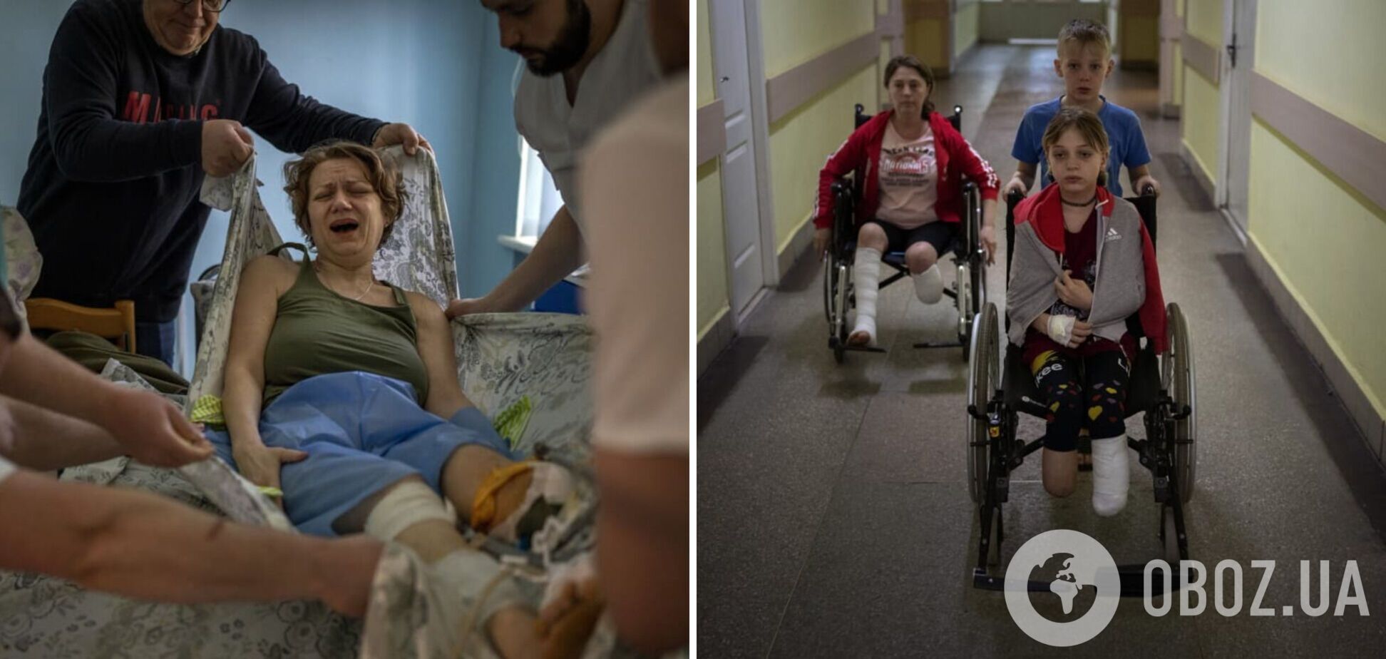 'Щодня звикаю до нового болю': українці отримали жахливі поранення внаслідок російських обстрілів. Фото 18+
