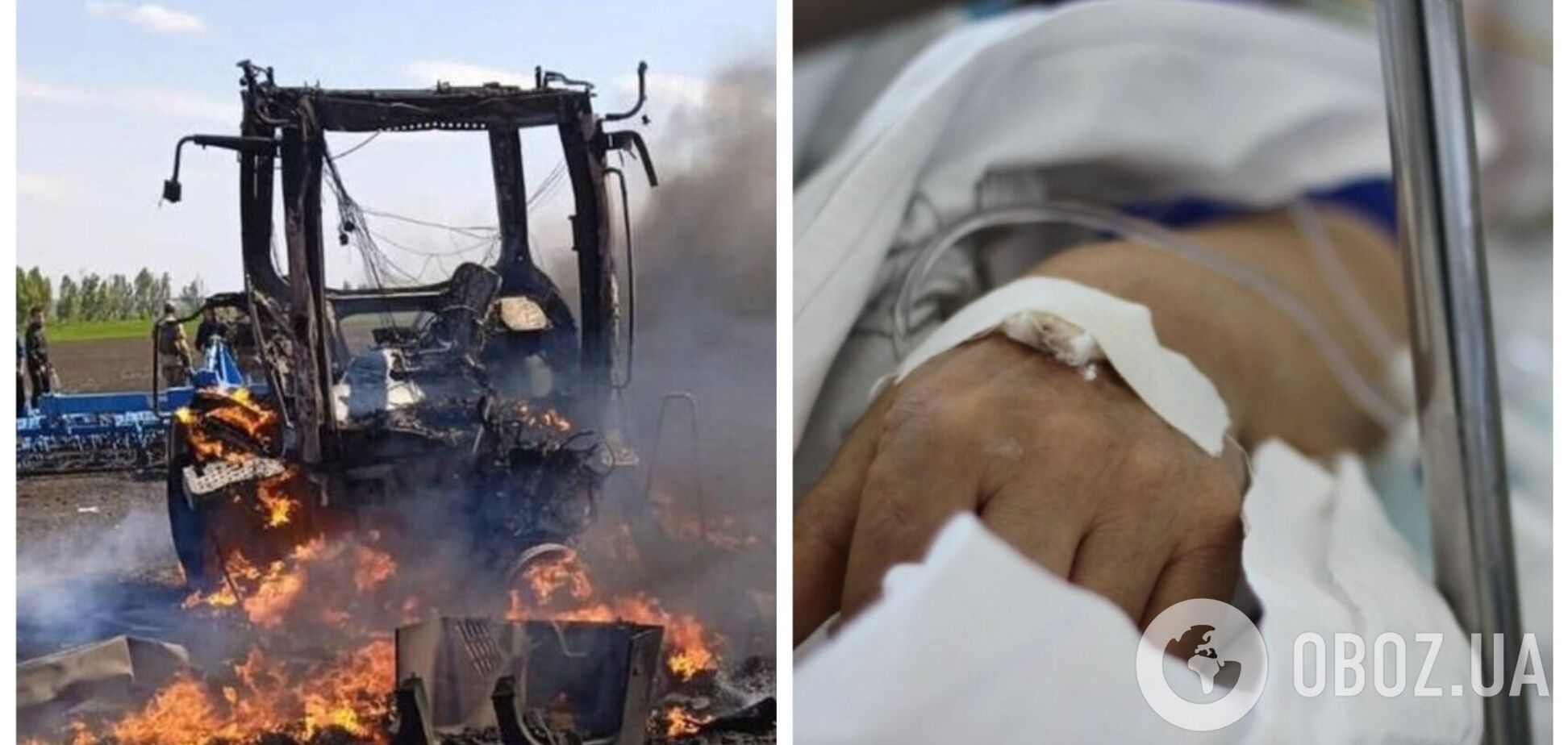 Умер тракторист, пострадавший от вражеского удара на Харьковщине: ракета попала в технику